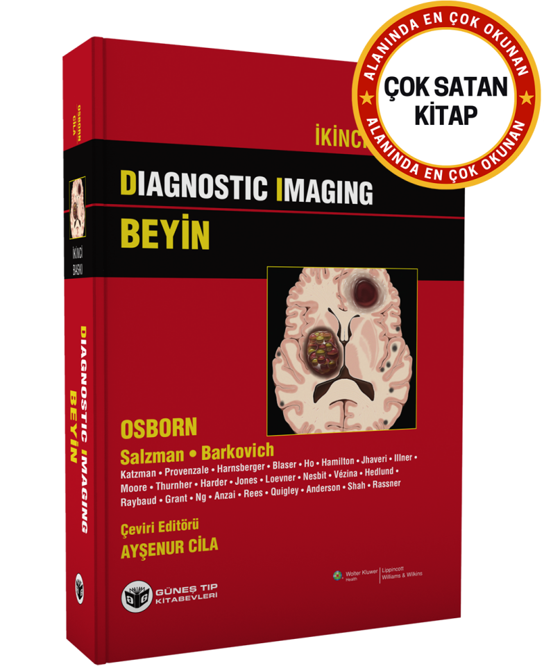 Diagnostic Imaging - Beyin