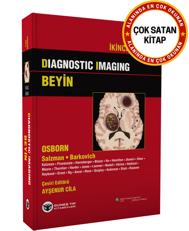 Diagnostic Imaging - Beyin