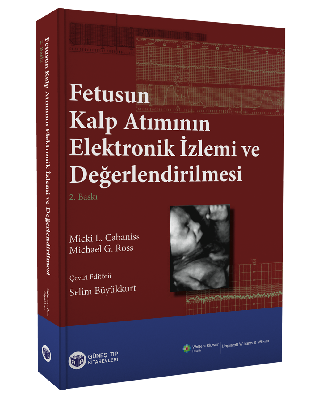 Fetusun Kalp Atımının Elektronik İzlemi ve Değerlendirilmesi