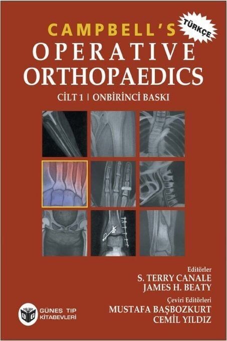 Campbell's Operative Orthopaedics 4 Cilt, Türkçesi